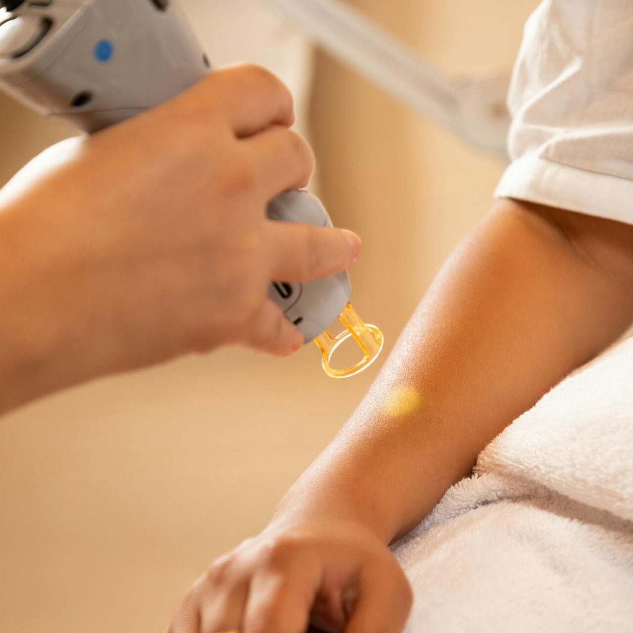 Servizio_epilazione_laser