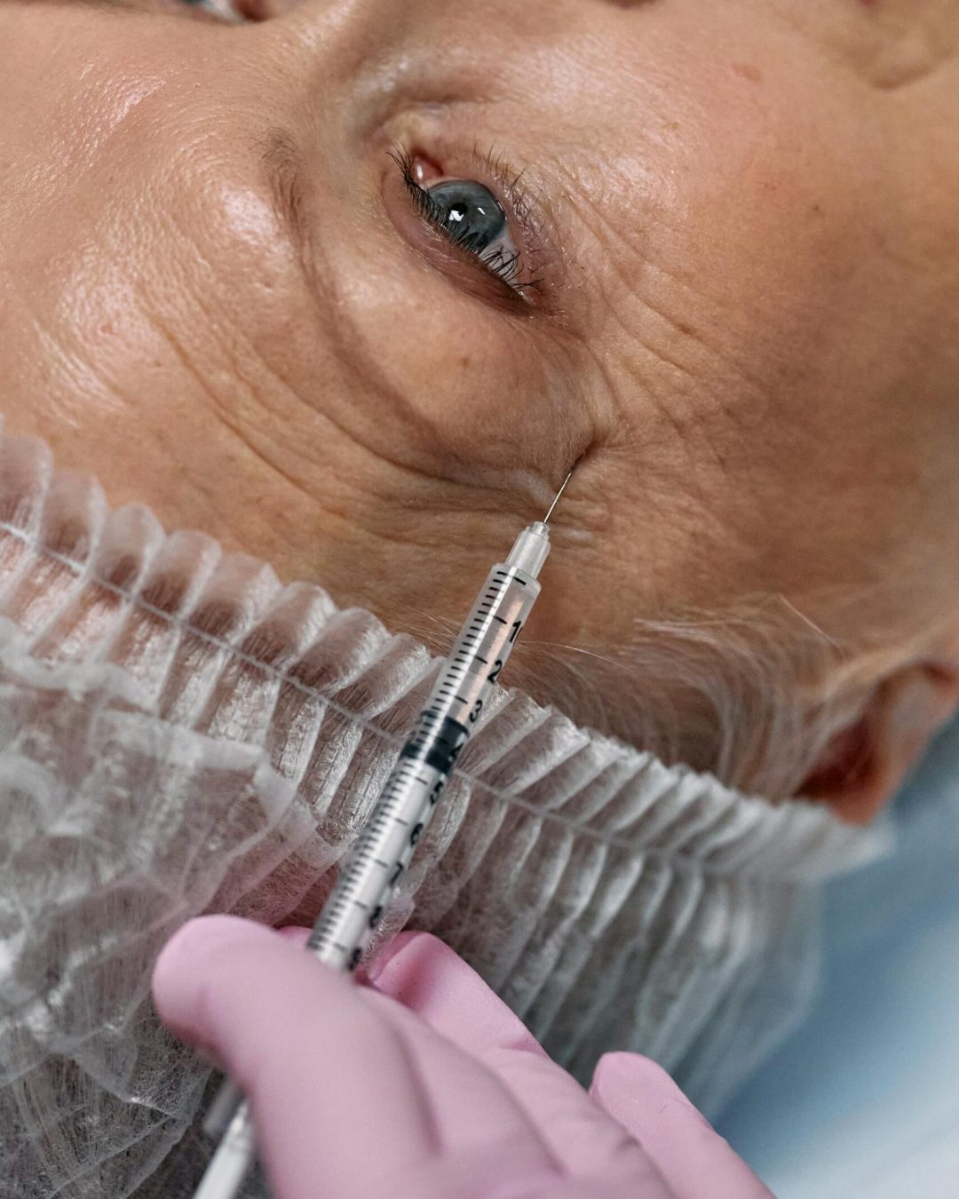 Trattamento viso collagene rope