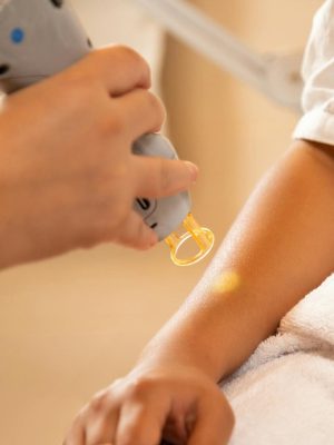 Servizio_epilazione_laser